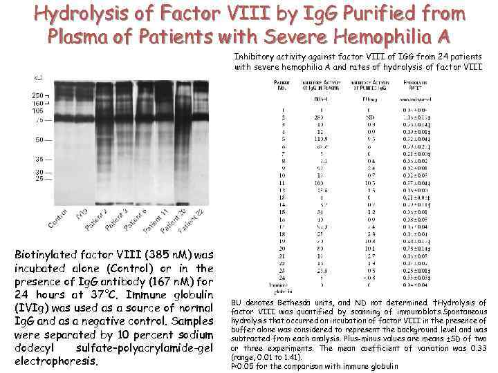 Hydrolysis of Factor VIII by Ig. G Purified from Plasma of Patients with Severe
