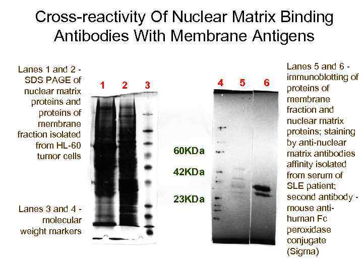 Cross-reactivity Of Nuclear Matrix Binding Antibodies With Membrane Antigens Lanes 1 and 2 -