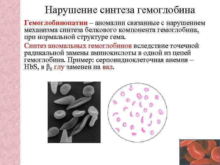 Нарушение синтеза. Нарушение синтеза гема и гемоглобина. Нарушение синтеза гемоглобина при талассемии гемоглобинопатии. Заболевания связанные с нарушением синтеза гемоглобина. Патологические формы гемоглобина гемоглобинопатии схема.