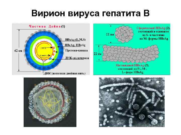 Вирион вируса гепатита В 