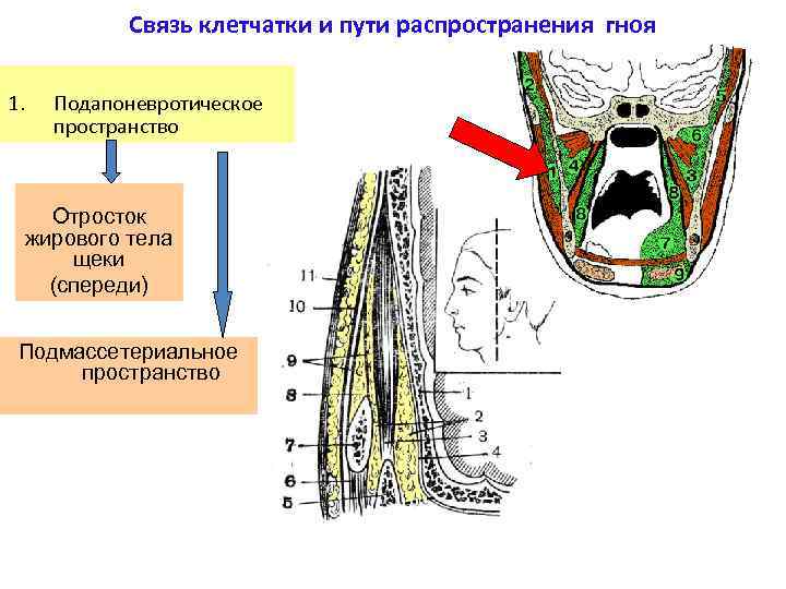 Связь клетчатки и пути распространения гноя 1. Подапоневротическое пространство Отросток жирового тела щеки (спереди)