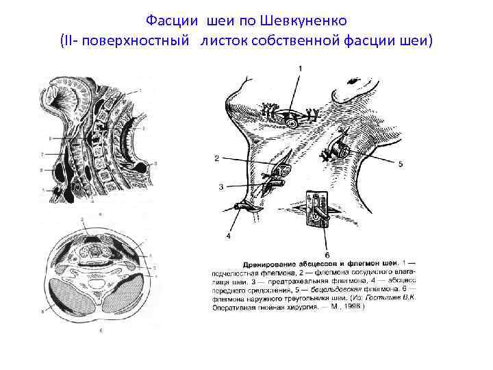 Фасции шеи по Шевкуненко (II- поверхностный листок собственной фасции шеи) 