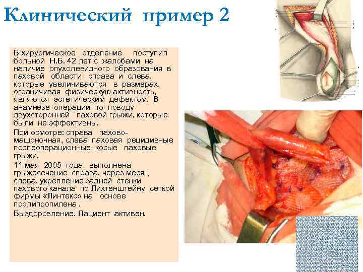 Клинический пример 2 В хирургическое отделение поступил больной Н. Б. 42 лет с жалобами