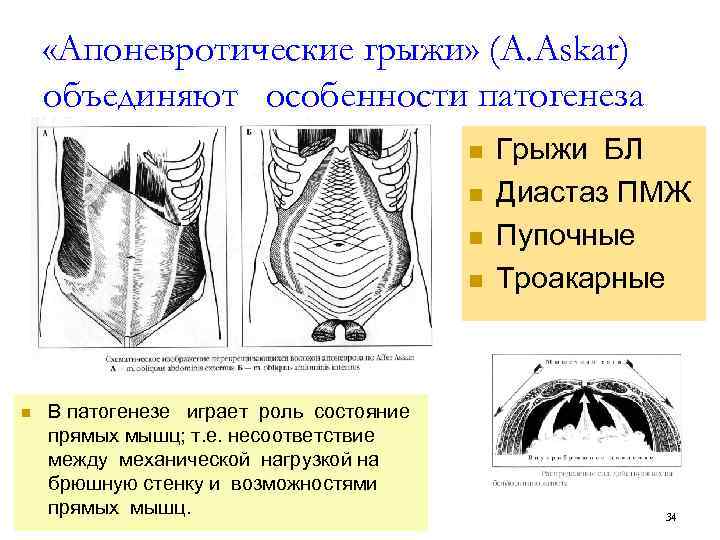  «Апоневротические грыжи» (A. Askar) объединяют особенности патогенеза n n n В патогенезе играет