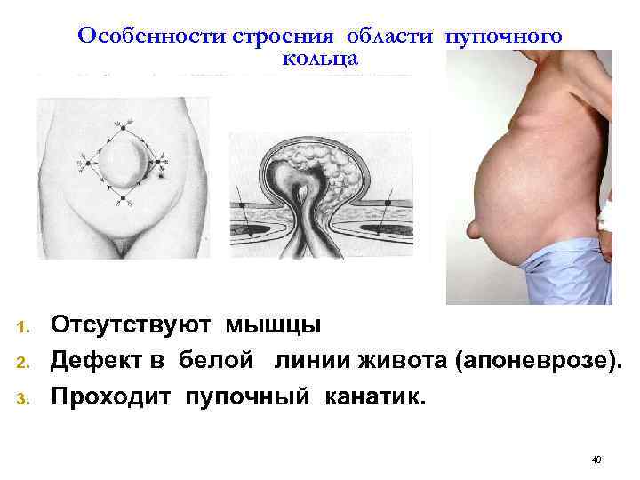 Пупочное кольцо анатомия