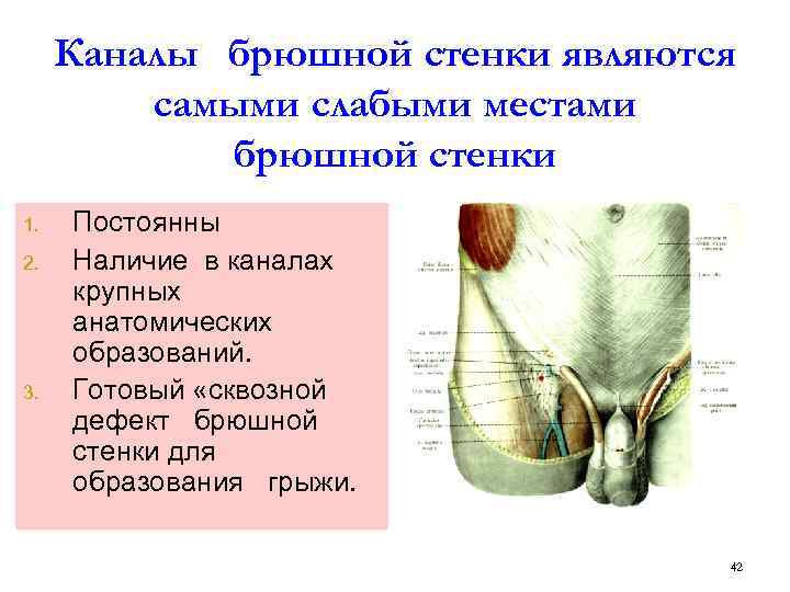 Каналы брюшной стенки являются самыми слабыми местами брюшной стенки 1. 2. 3. Постоянны Наличие