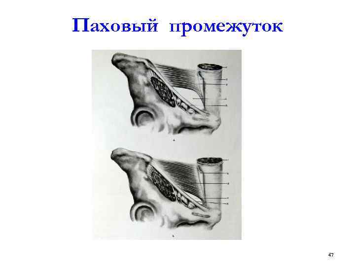 Паховый промежуток 47 