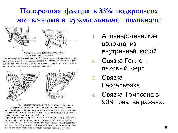 Схема пластики пахового канала