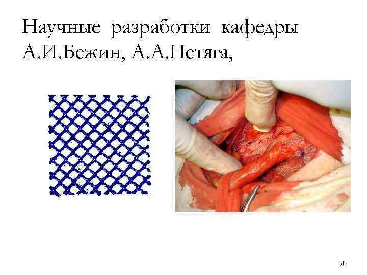 Научные разработки кафедры А. И. Бежин, А. А. Нетяга, 71 