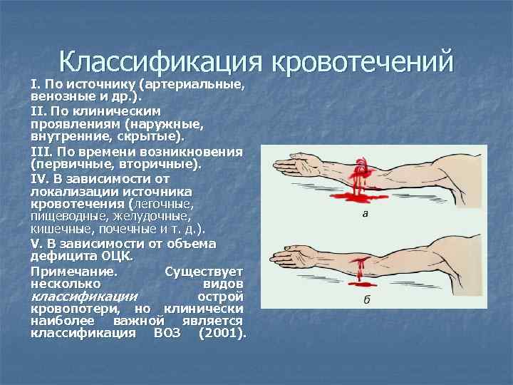 Классификация кровотечений I. По источнику (артериальные, венозные и др. ). II. По клиническим проявлениям