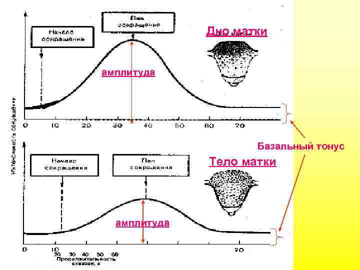 Дно матки амплитуда Базальный тонус Тело матки амплитуда 