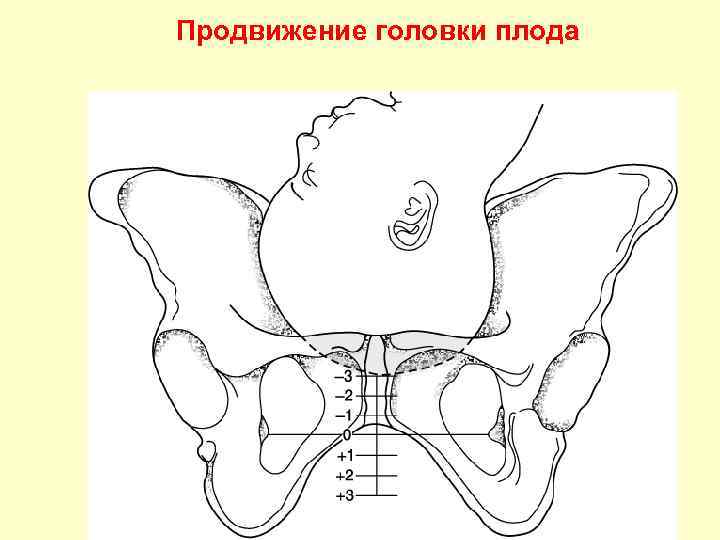 Продвижение головки плода 