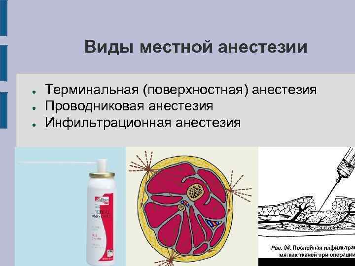 Что значит местная анестезия