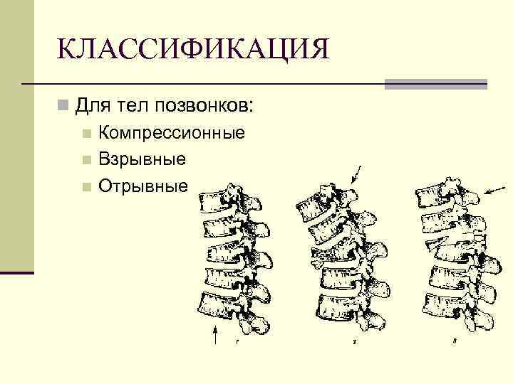 КЛАССИФИКАЦИЯ n Для тел позвонков: n Компрессионные n Взрывные n Отрывные 