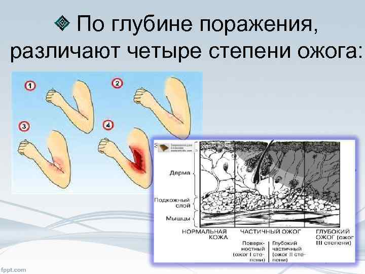 Ожог карта смп