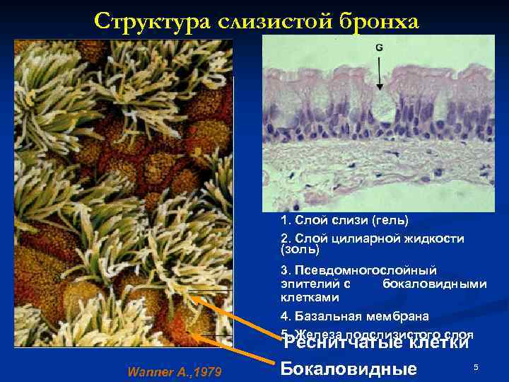 Структура слизистой бронха 1. Слой слизи (гель) 2. Слой цилиарной жидкости (золь) 3. Псевдомногослойный