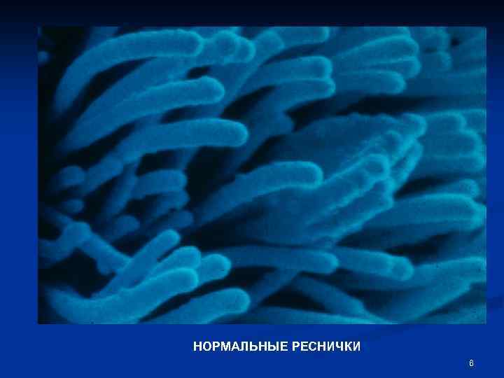 НОРМАЛЬНЫЕ РЕСНИЧКИ 6 