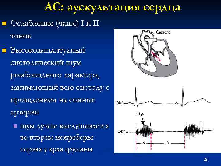 Звук тонов сердца. Аускультация шумов при пороках сердца. Тоны сердца приглушены систолический шум это. Акцент 2 тона систолический шум на верхушке. Митральный стеноз II тона выслушивается.