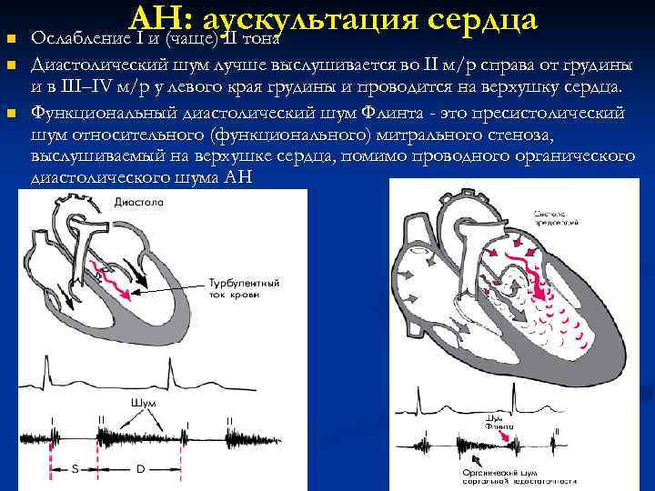 Шум на верхушке сердца свидетельствует о поражении