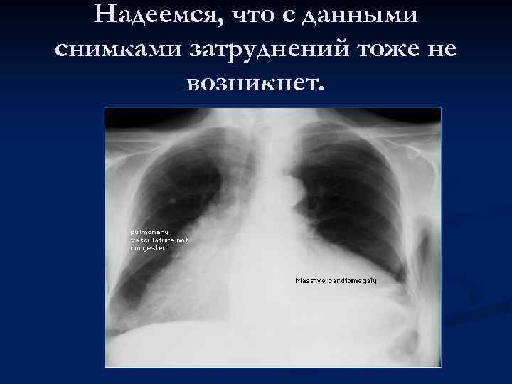 Надеемся, что с данными снимками затруднений тоже не возникнет. 