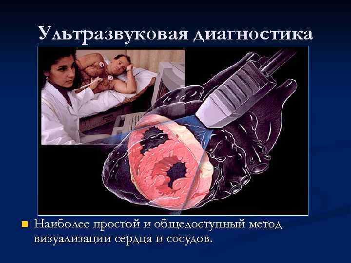 Ультразвуковая диагностика n Наиболее простой и общедоступный метод визуализации сердца и сосудов. 