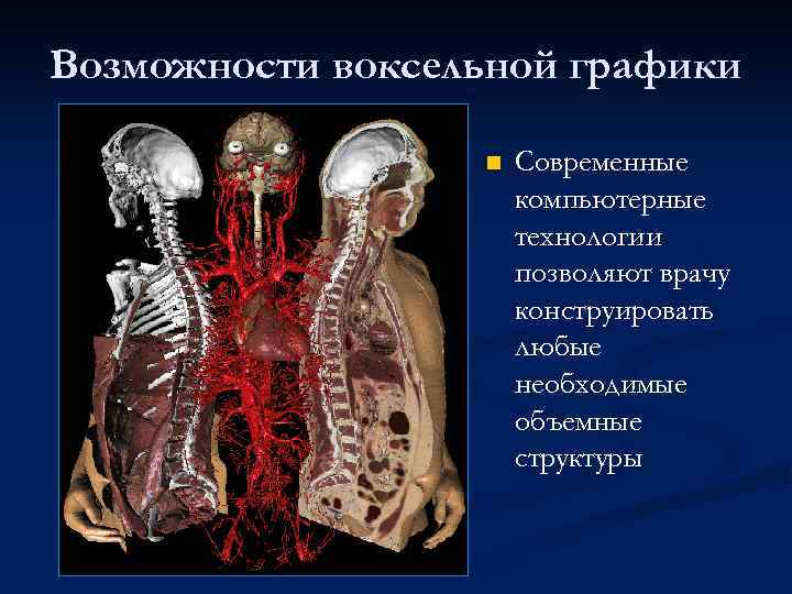 Возможности воксельной графики n Современные компьютерные технологии позволяют врачу конструировать любые необходимые объемные структуры