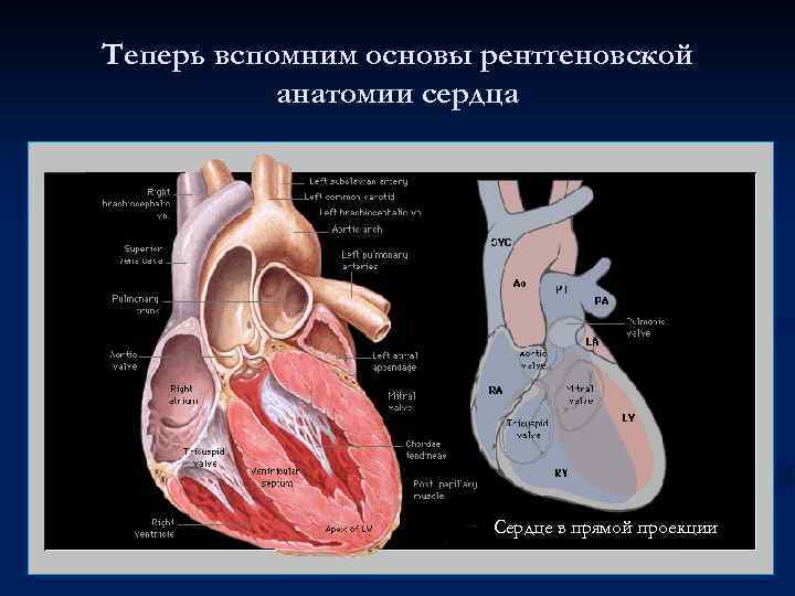 Теперь вспомним основы рентгеновской анатомии сердца Сердце в прямой проекции 