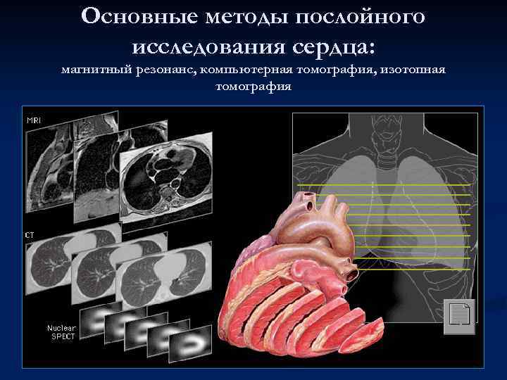 Основные методы послойного исследования сердца: магнитный резонанс, компьютерная томография, изотопная томография 