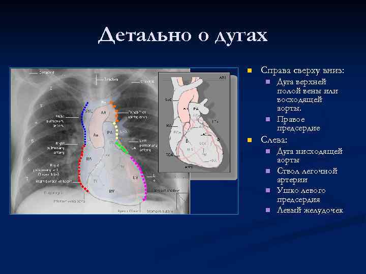 Детально о дугах n Справа сверху вниз: n n n Дуга верхней полой вены