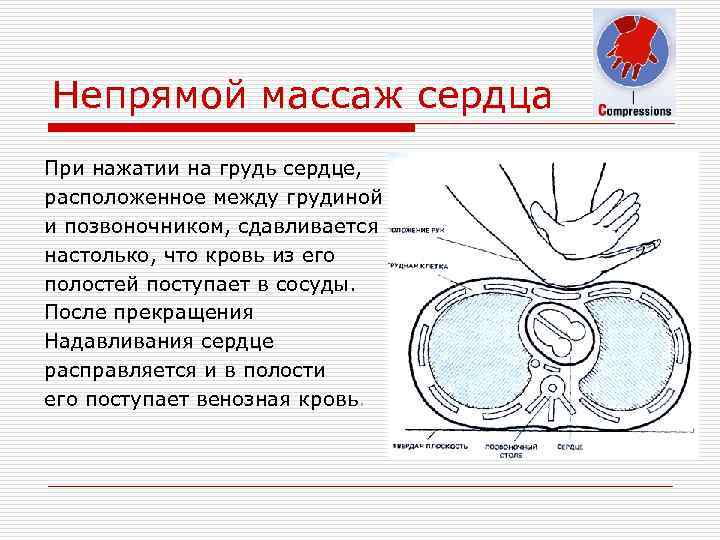 Непрямой массаж сердца При нажатии на грудь сердце, расположенное между грудиной и позвоночником, сдавливается