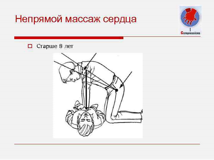 Непрямой массаж сердца o Старше 8 лет 