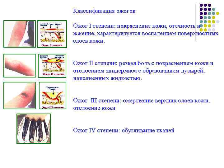 Термический ожог 1 степени карта вызова