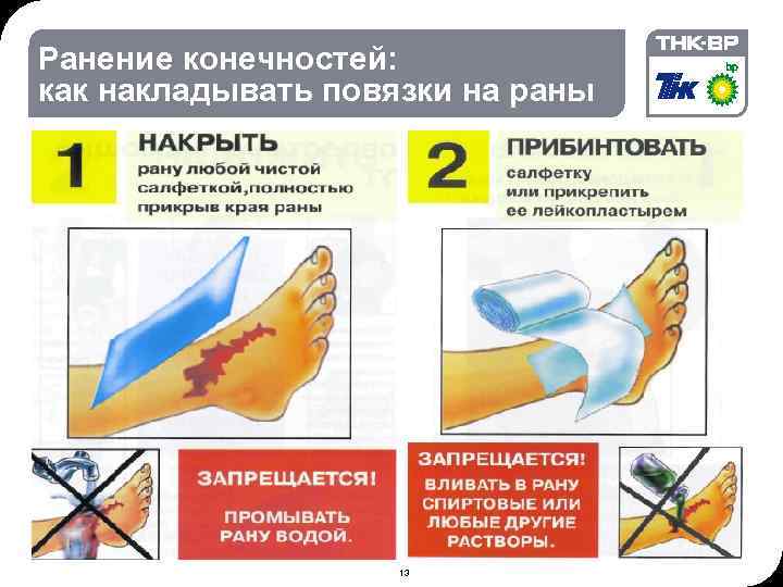 09: 09 © THK-BP presentation name Ранение конечностей: как накладывать повязки на раны •