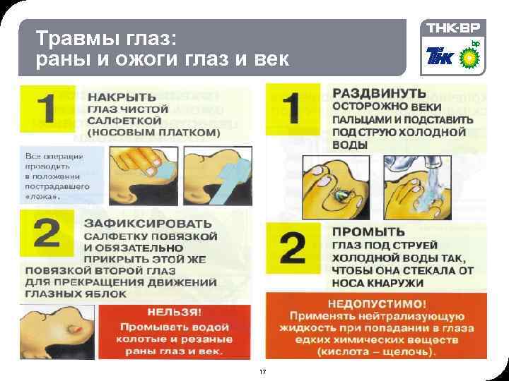 09: 09 © THK-BP presentation name Травмы глаз: раны и ожоги глаз и век