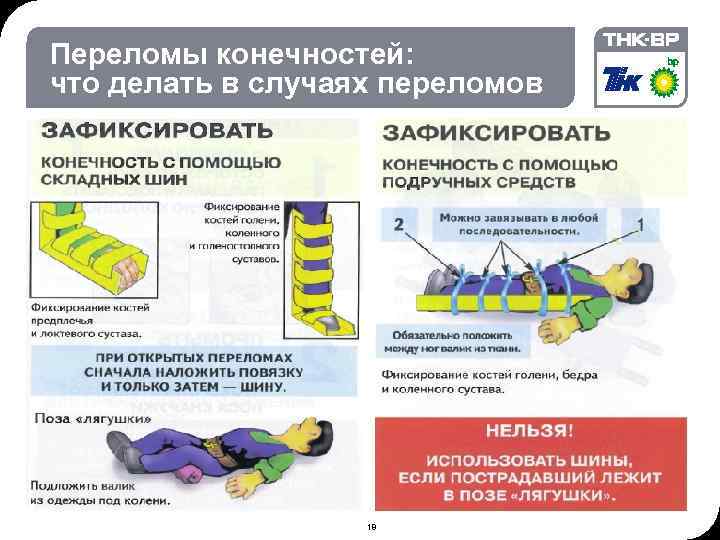 09: 09 © THK-BP presentation name Переломы конечностей: что делать в случаях переломов •