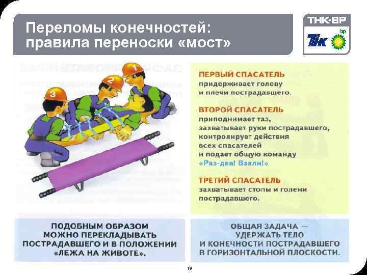 09: 09 © THK-BP presentation name Переломы конечностей: правила переноски «мост» • 1 19