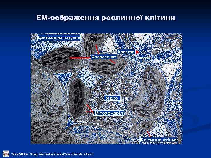 ЕМ-зображення рослинної клітини Центральна вакуоля Кристал Хлоропласт Ядро Мітохондрія Клітинна стінка Valeriy Polischuk Virology