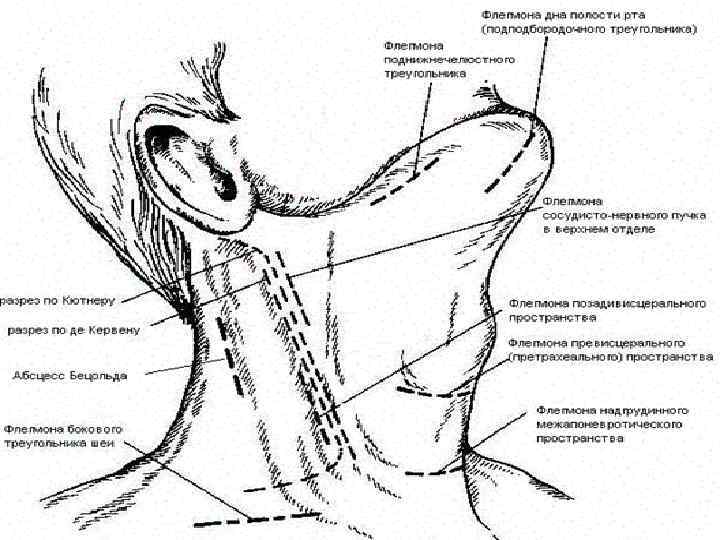 Фасции и клетчаточные пространства шеи схема