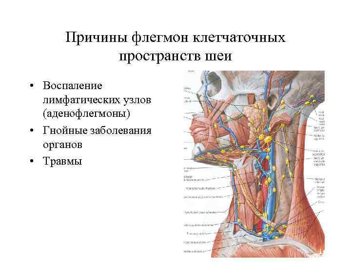 Причины флегмон клетчаточных пространств шеи • Воспаление лимфатических узлов (аденофлегмоны) • Гнойные заболевания органов