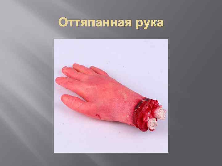 Оттяпанная рука 