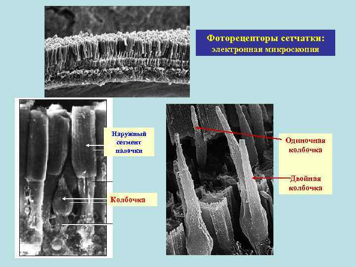 Фоторецепторы сетчатки: электронная микроскопия Наружный сегмент палочки Одиночная колбочка Двойная колбочка Колбочка 