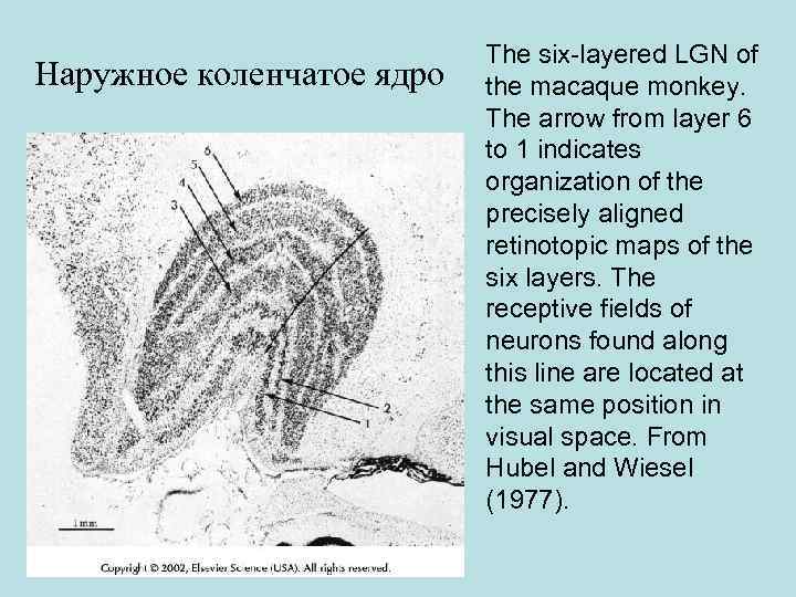 Наружное коленчатое ядро The six-layered LGN of the macaque monkey. The arrow from layer