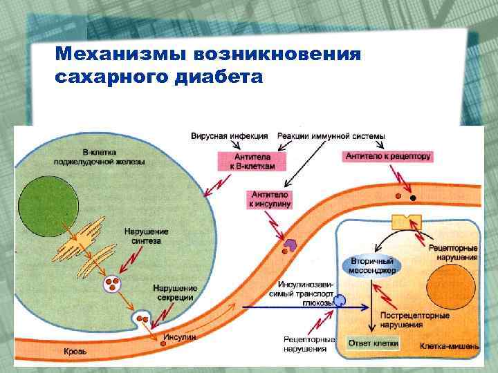 Механизмы возникновения сахарного диабета 