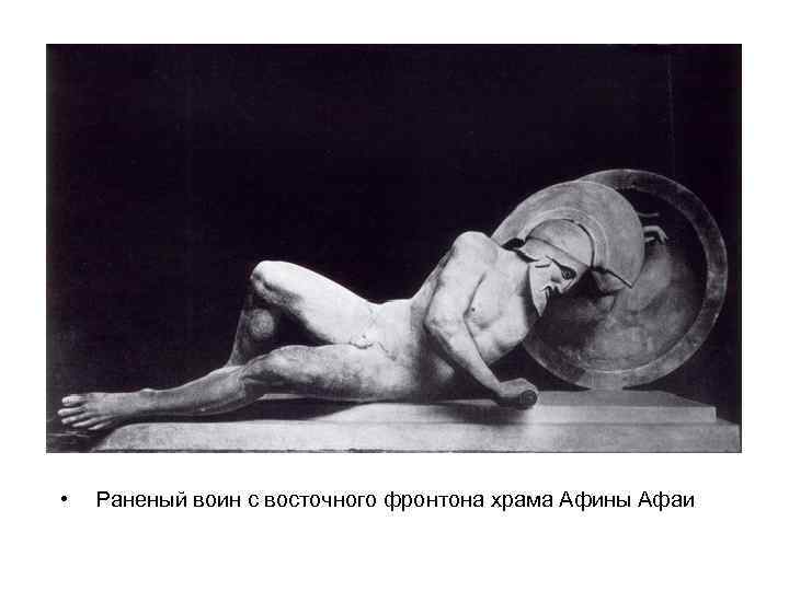 • Раненый воин с восточного фронтона храма Афины Афаи 