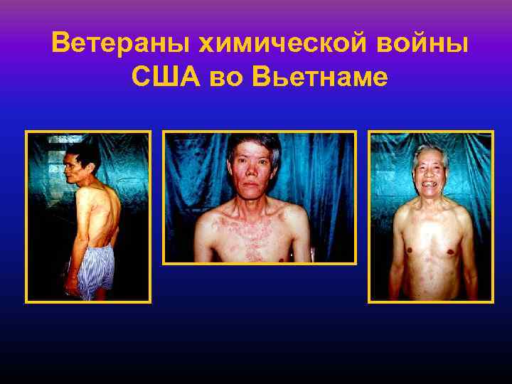 Ветераны химической войны США во Вьетнаме 