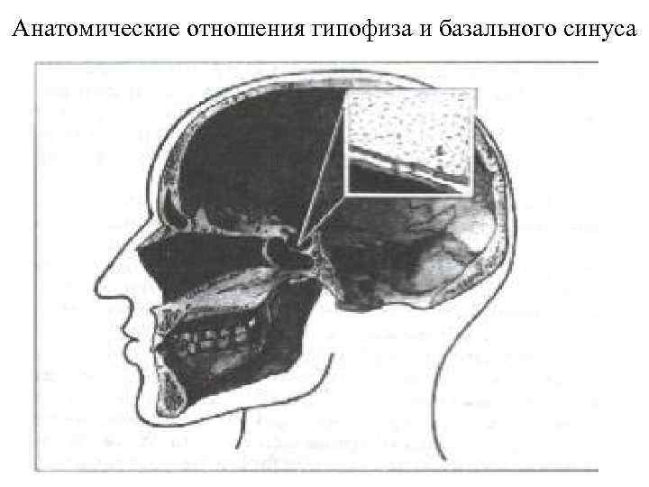 Анатомические отношения гипофиза и базального синуса 