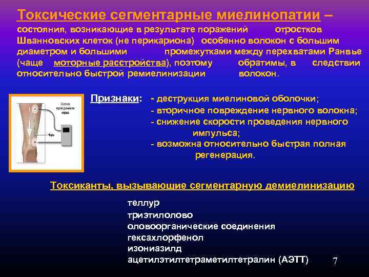 Токсические сегментарные миелинопатии – состояния, возникающие в результате поражений отростков Шванновских клеток (не перикариона)