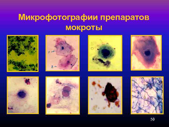 Микрофотографии препаратов мокроты 50 