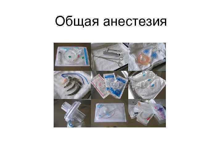 Общая анестезия 