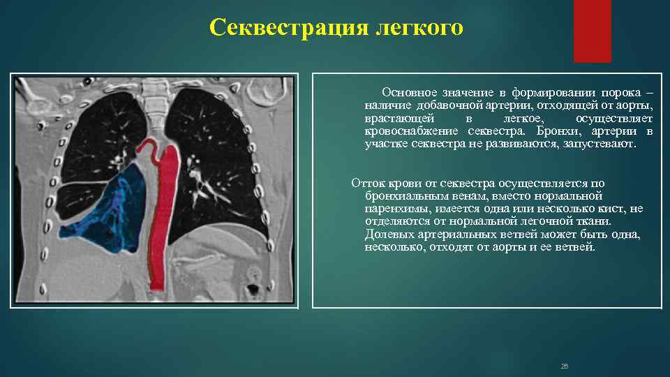 Секвестрация легкого Основное значение в формировании порока – наличие добавочной артерии, отходящей от аорты,